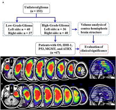 Contrahemispheric Cortex Predicts Survival and Molecular Markers in Patients With Unilateral High-Grade Gliomas